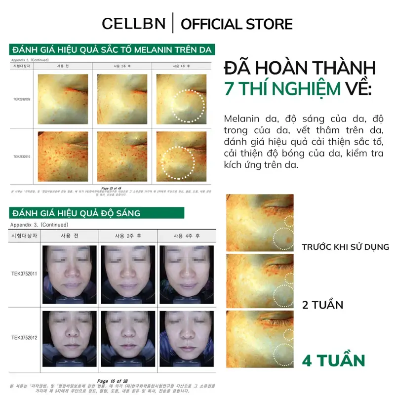 Set Hỗ Trợ Giảm Sắc Tố - Giảm Sạm Nám An Toàn CELLBN (Blemish Spot Cream & Black Spot Patch) - ảnh 4