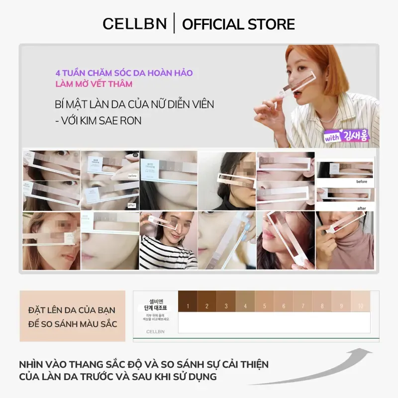 Set Hỗ Trợ Giảm Sắc Tố - Giảm Sạm Nám An Toàn CELLBN (Blemish Spot Cream & Black Spot Patch) - ảnh 5